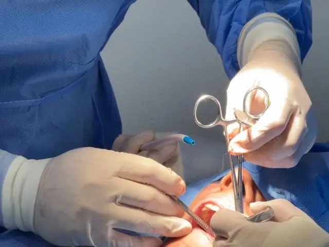 Cirugia - Clinica Dental Amanda
